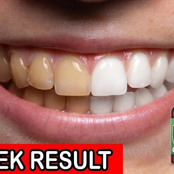 Photo of Reverse all dental problems like teeth cavity, tooth ache , bleeding gums etc