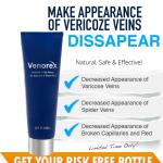 Treat Varicose Veins And Spider Veins at Home