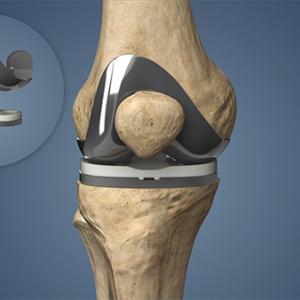 Photo of Unlock Pain-Free Movement: Discover the Knee Restoration Ritual